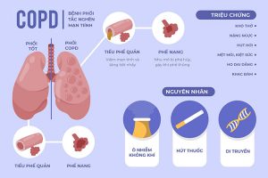 bệnh phổi tắc nghẽn mạn tính